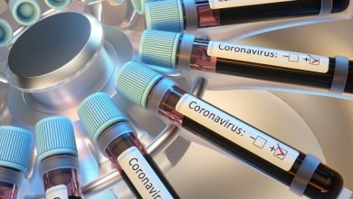 زنگ خطر گسترش ویروس کرونا در روستاهای کردستان به‌صدا درآمد